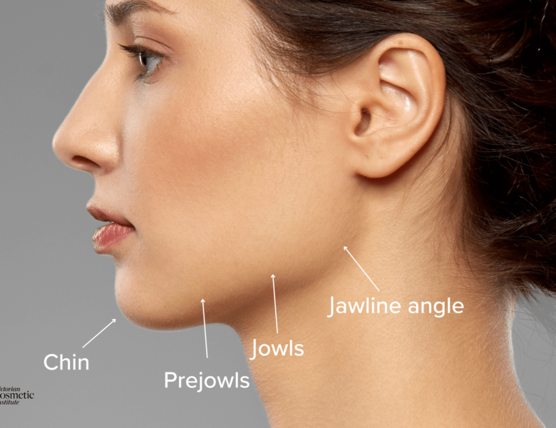 How long do jawline fillers last?