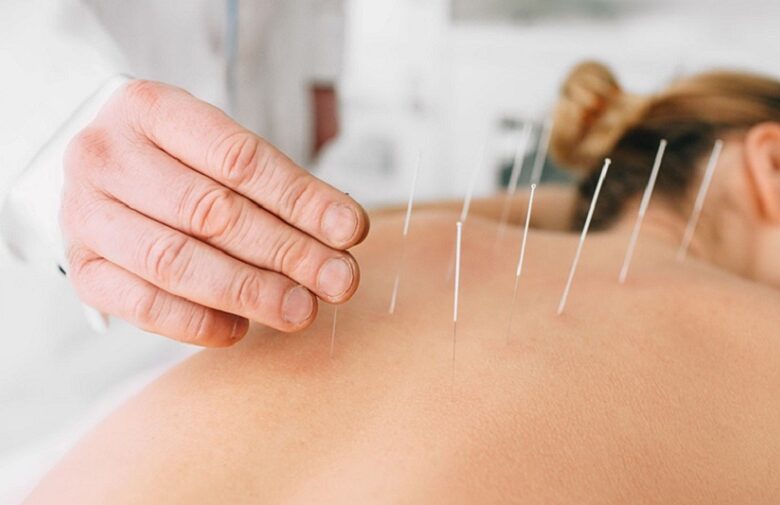 Dos & Don’ts to Follow After Acupuncture Treatments